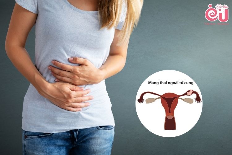 Mang thai khi lớn tuổi sẽ tăng nguy cơ bị chửa ngoài tử cung