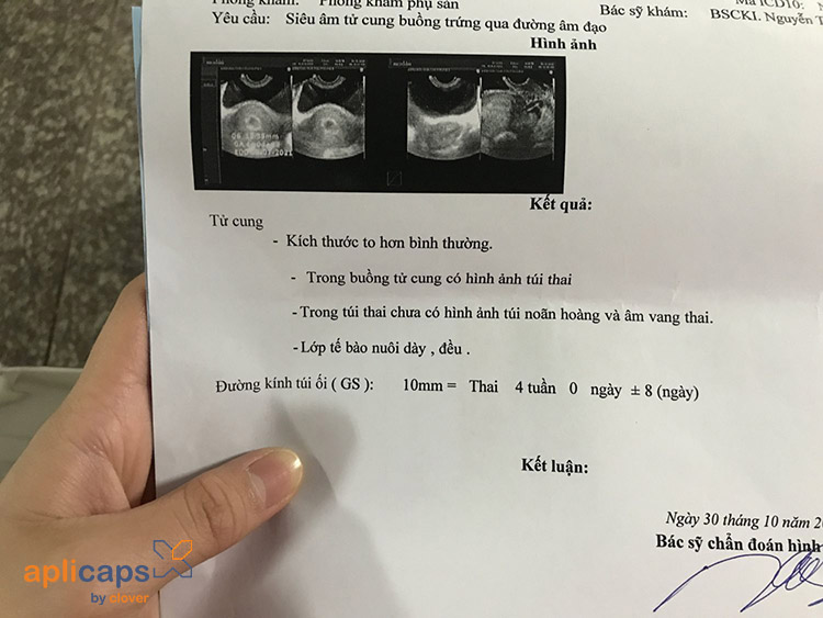 Xem hình ảnh giấy siêu âm thai 5 tuần trực quan và chi tiết
