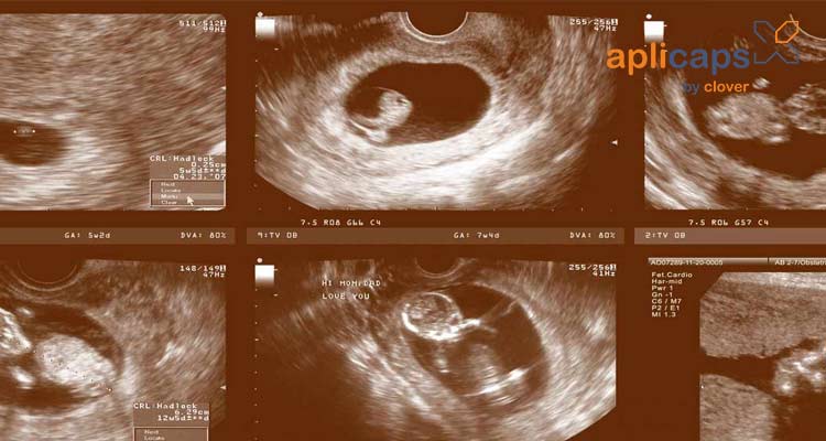 Hình ảnh siêu âm thai nhi tuần thứ 20