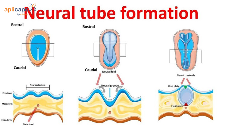 Acid Folic ngăn ngừa nguy cơ dị tật ống thần kinh ở thai nhi