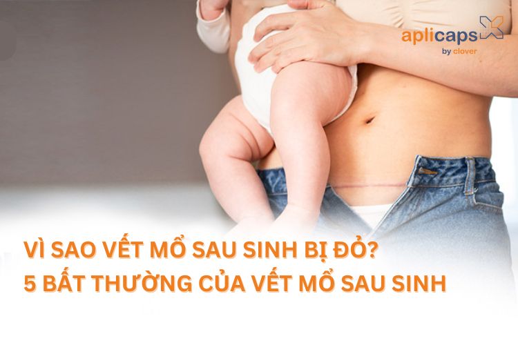 vết mổ sau sinh bị đỏ