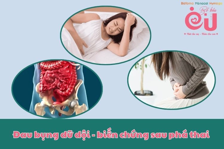 Đau bụng dữ dội là một trong những biến chứng sau phá thai cần lưu ý