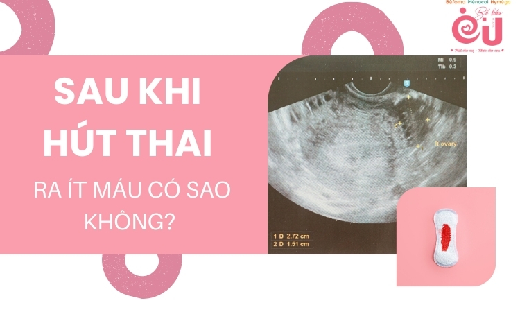 sau-khi-hut-thai-ra-it-mau-co-sao-khong