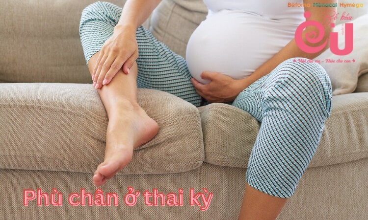 Mang thai có thể gây phù chân