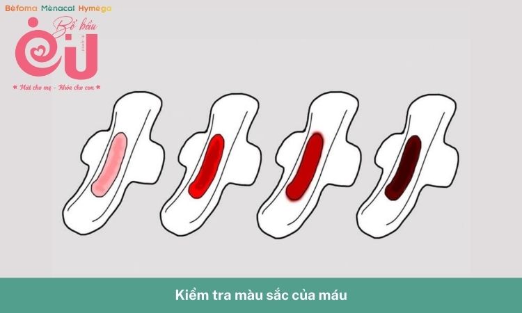 Theo dõi màu sắc để xác định có phải máu báo thai hay không
