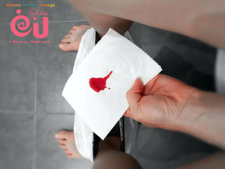 Bà bầu bị ra máu trong thai kỳ không đau bụng có thể do nhiều nguyên nhân khác nhau