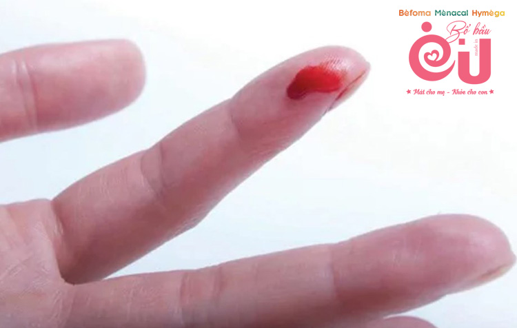 Lượng máu chảy cho biết đây là tình trạng nghiêm trọng hay không