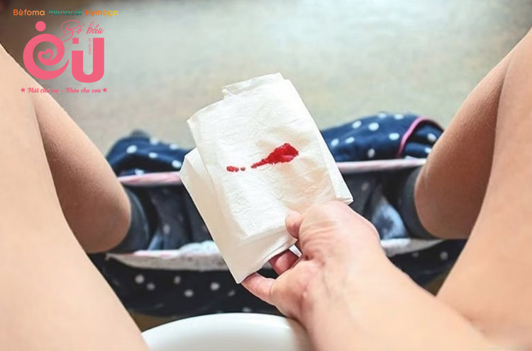 Hiện tượng ra máu đỏ tươi trong 3 tháng đầu có thể do mẹ bị sảy thai