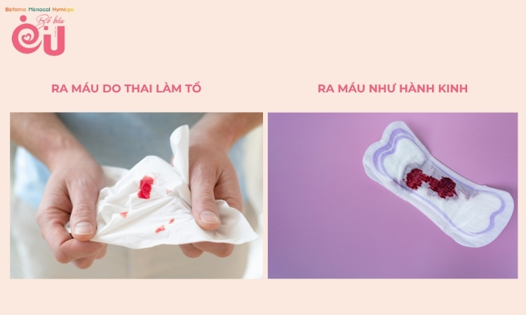 Phân biệt "ra máu nhẹ" và "ra máu như hành kinh"