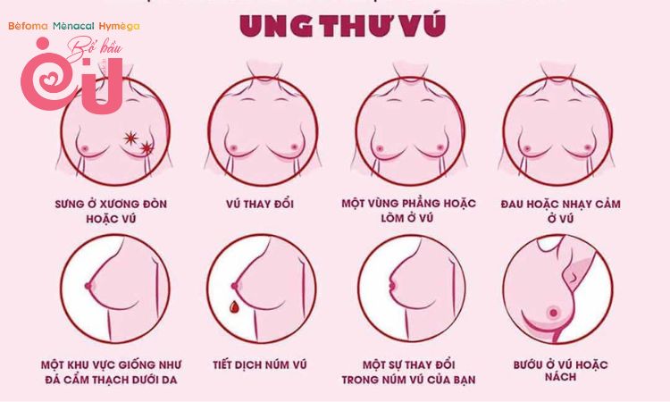 Những triệu chứng thường gặp của bệnh ung thư vú