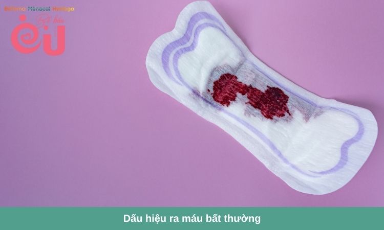 Liên hệ bác sĩ ngay khi thấy máu ra nhiều bất thường