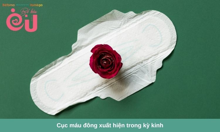 Cục máu đông xuất hiện trong kỳ kinh là hiện tượng bình thường