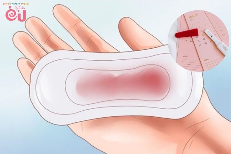 Máu báo thai là nguyên nhân thai 7 tuần ra máu đỏ tươi không đau bụng