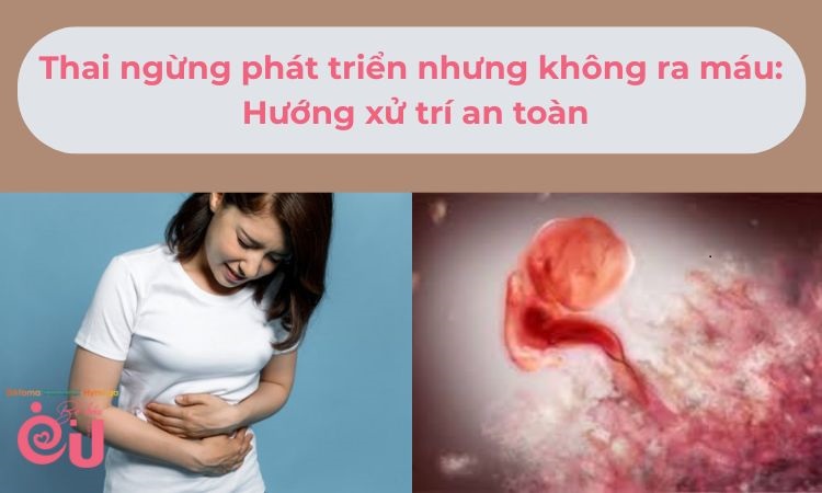 Thai ngừng phát triển nhưng không ra máu